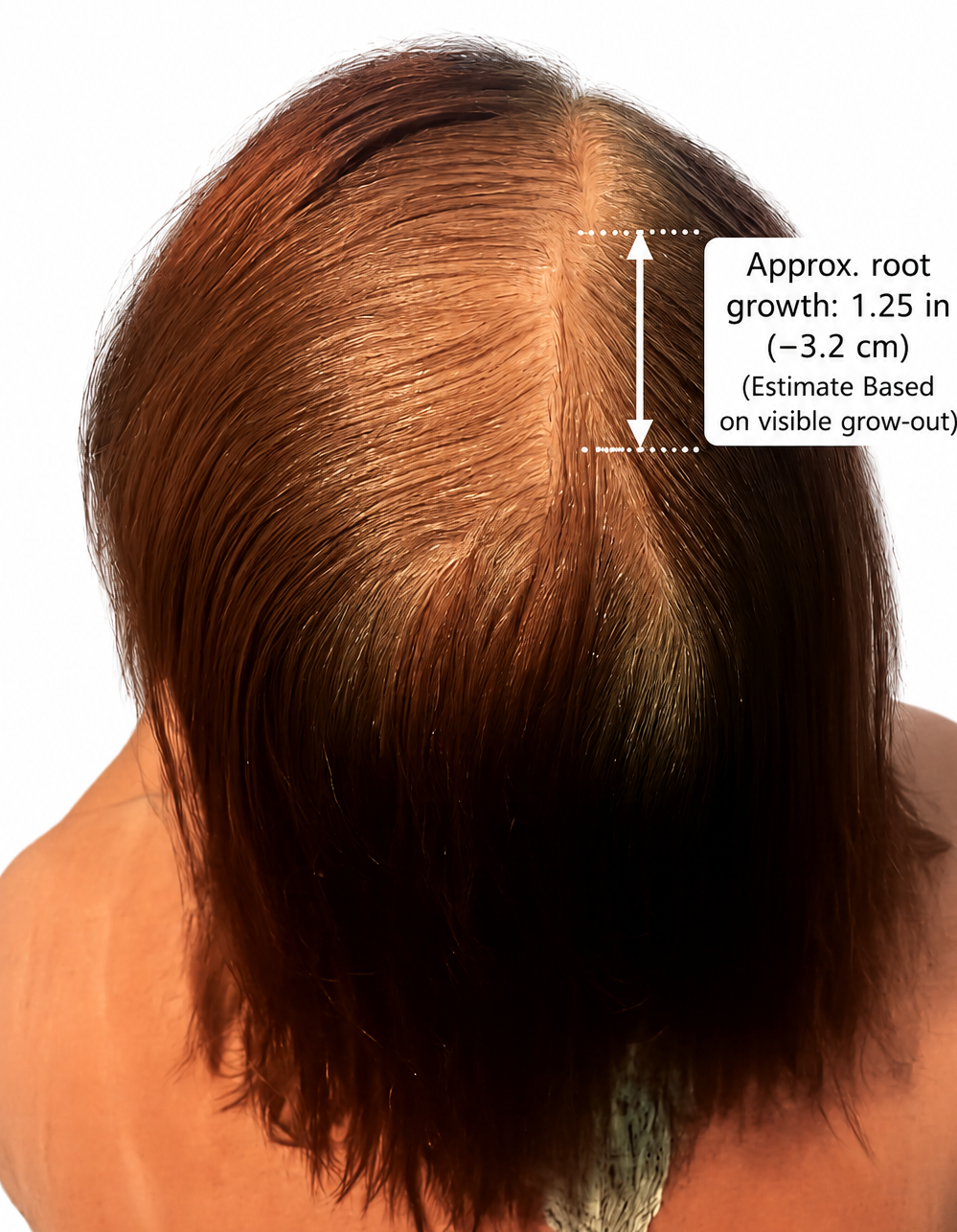 Scalp & Hair Growth Support Oil | Herbal Scalp Serum
